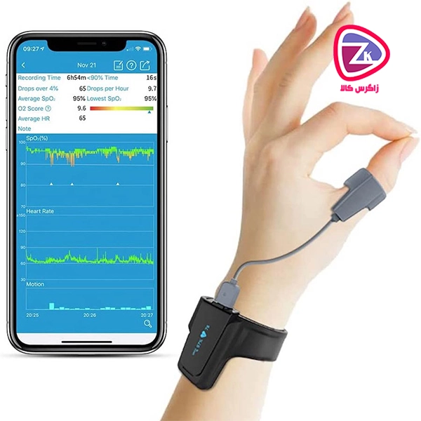 نحوه استفاده از دستگاه پالس اکسیمتر مچی Checkme O2 MAX